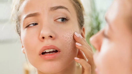 Dry skin and its challenges